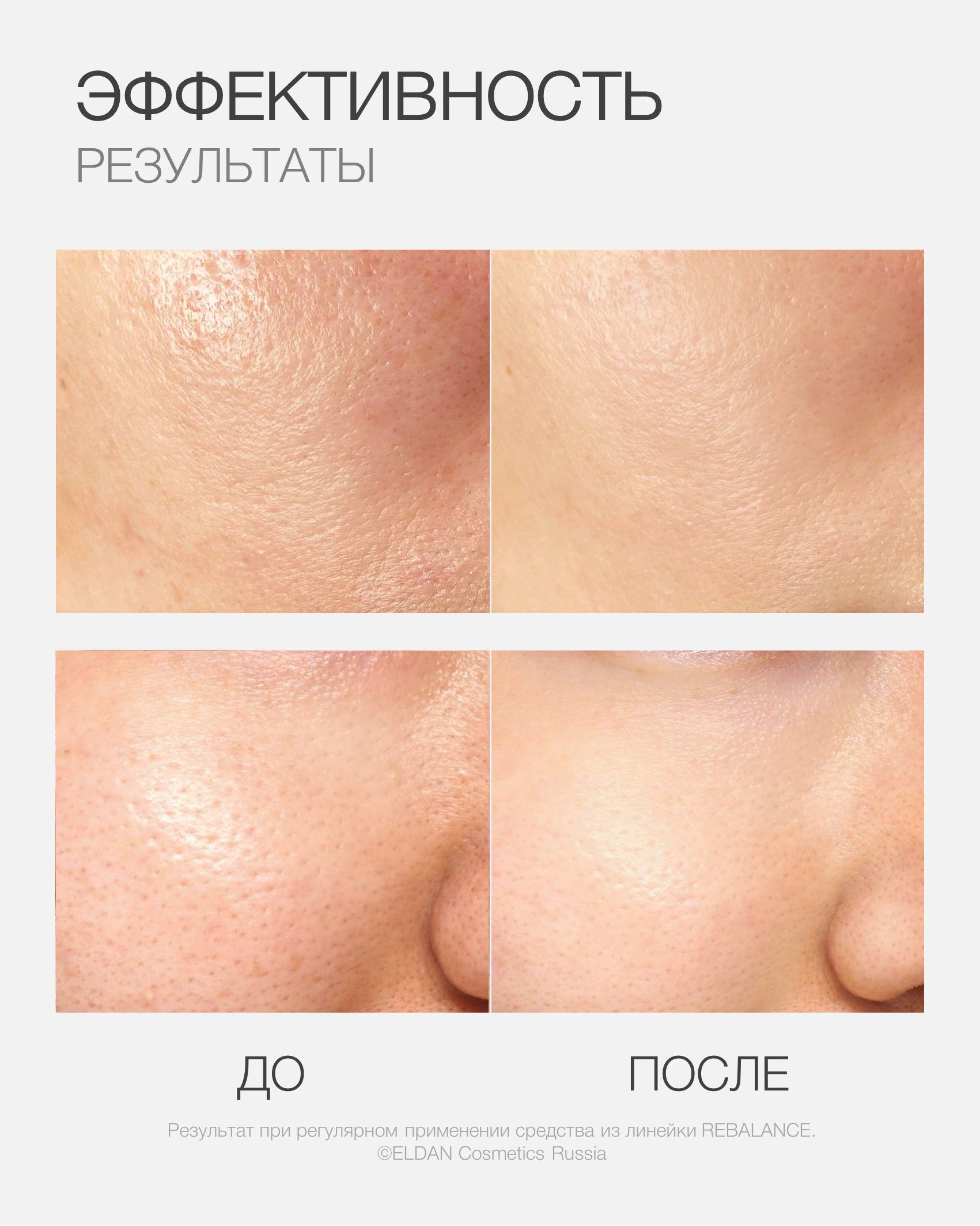 Пост матовая кожа 6.jpg